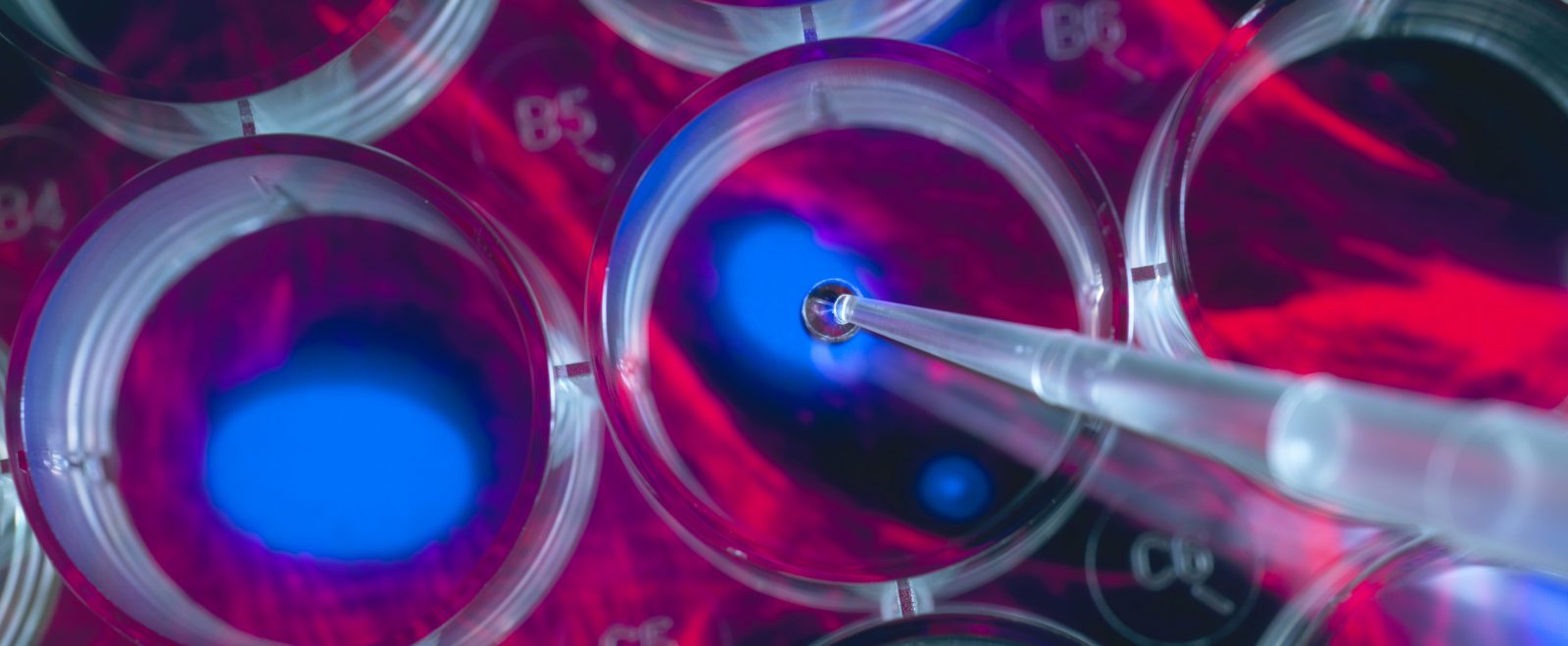 Stem cell research, scientist pipetting cells into a multi well plate with screen image of stem cells in the background