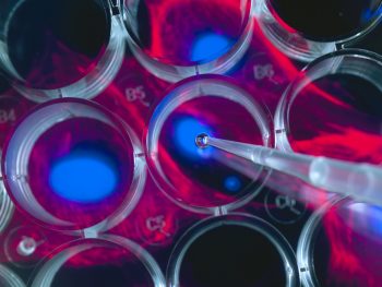 Stem cell research, scientist pipetting cells into a multi well plate with screen image of stem cells in the background