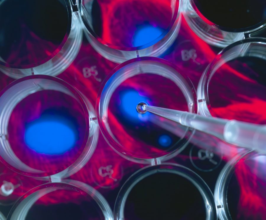 Stem cell research, scientist pipetting cells into a multi well plate with screen image of stem cells in the background