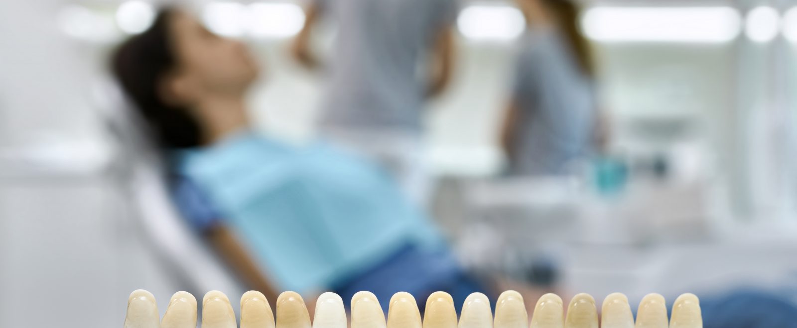 Teeth shade guide on the blurred background of a dental cabinet with patient and dentists
