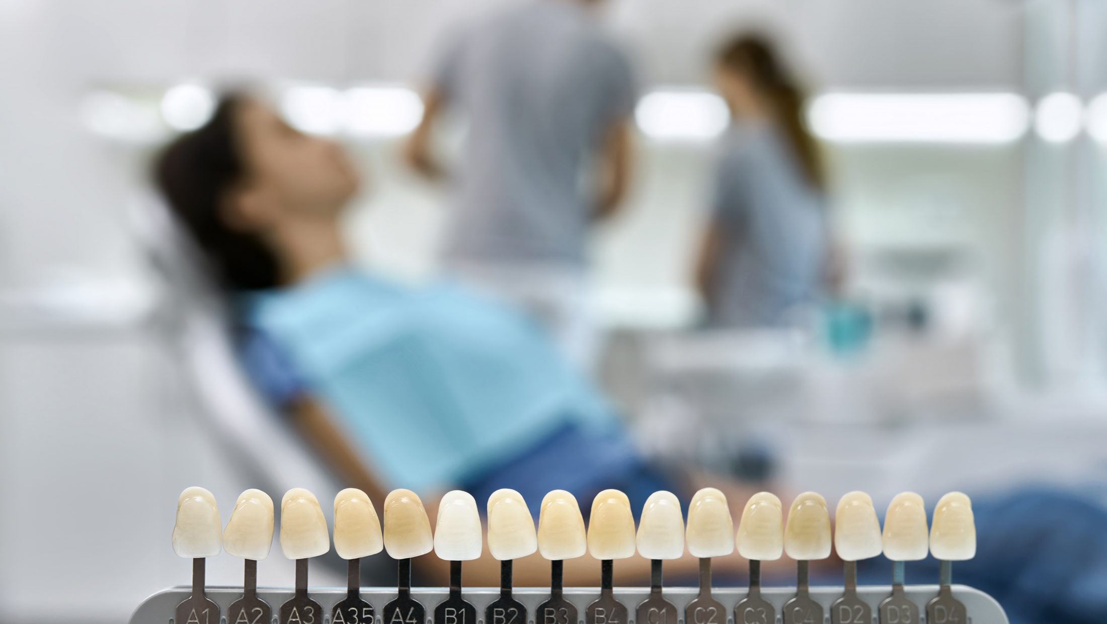 Teeth shade guide on the blurred background of a dental cabinet with patient and dentists