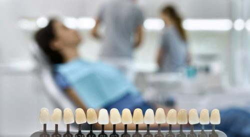 Teeth shade guide on the blurred background of a dental cabinet with patient and dentists