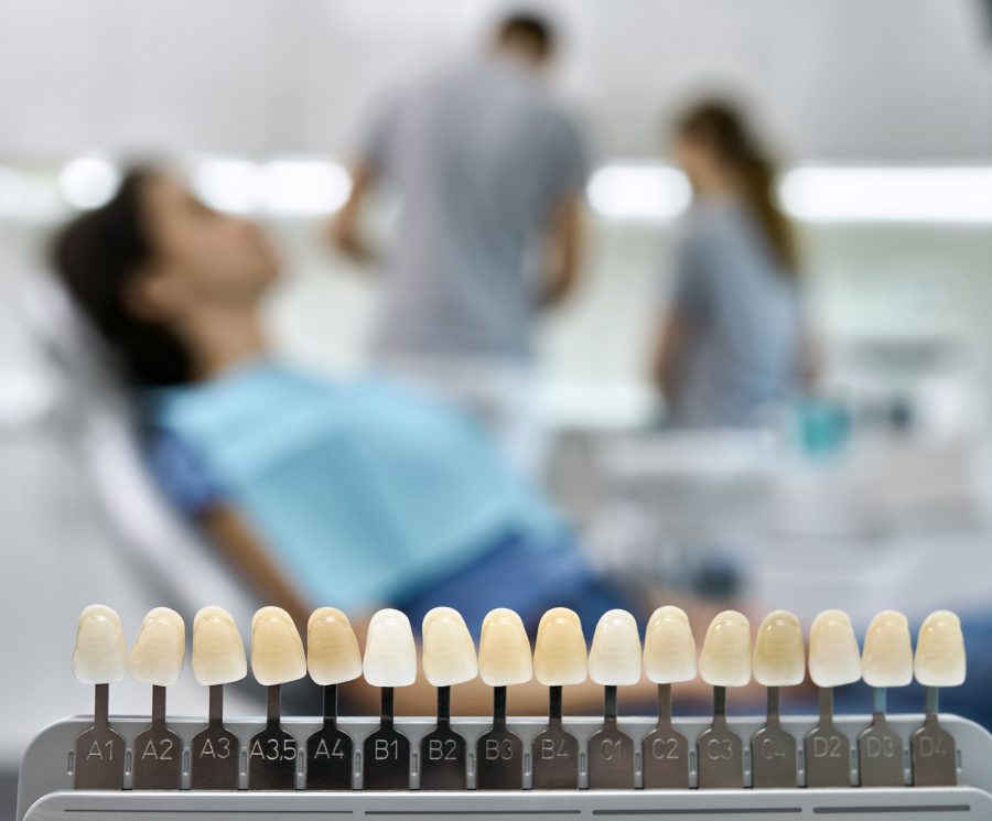 Teeth shade guide on the blurred background of a dental cabinet with patient and dentists