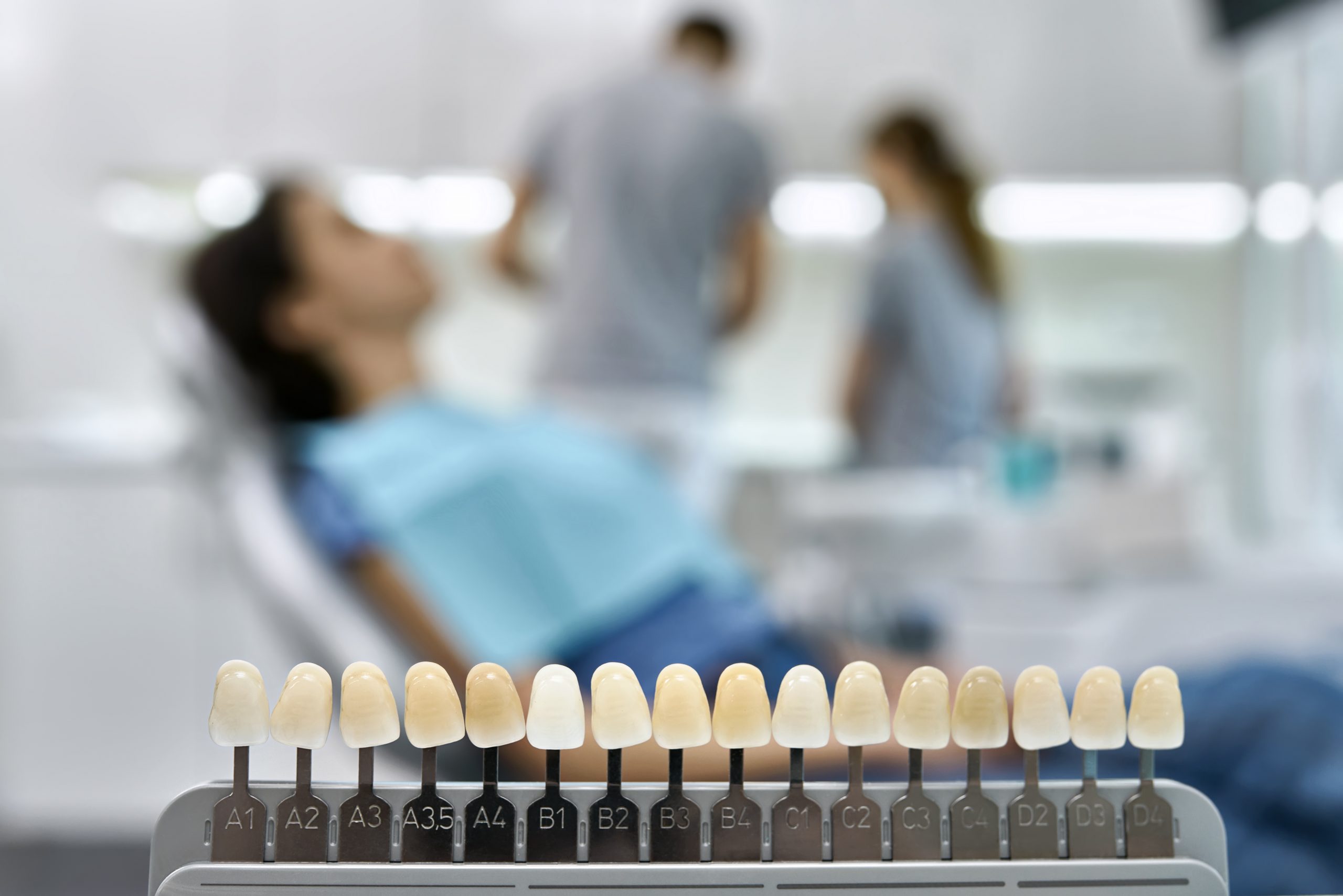 Teeth shade guide on the blurred background of a dental cabinet with patient and dentists