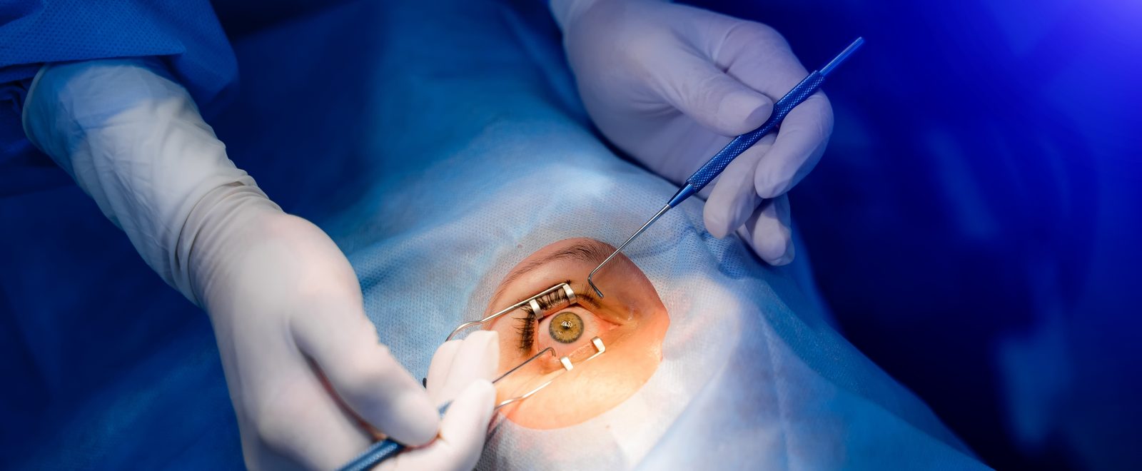 Ophthalmic surgery
